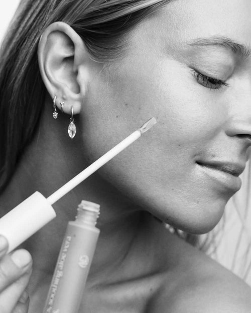 Aevi Blemish Treatment lifestyle – clinically proven blemish spot treatment